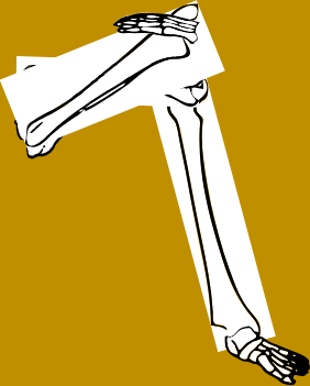 Dem bones dem bones dem – dry bones!