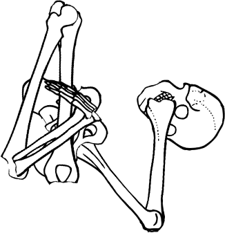 Dem bones dem bones dem – dry bones!