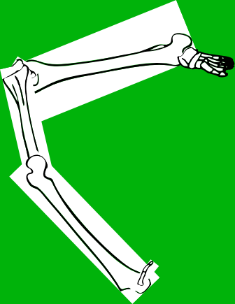 Dem bones dem bones dem – dry bones!