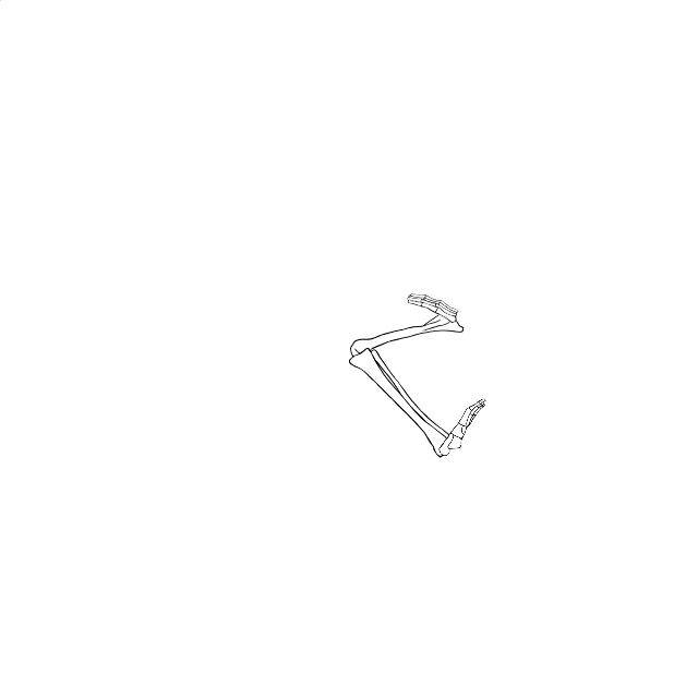 Dem bones dem bones dem – dry bones!
