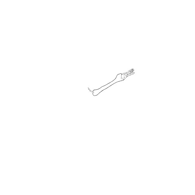 Dem bones dem bones dem – dry bones!