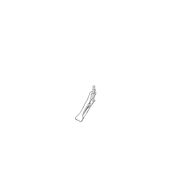 Dem bones dem bones dem – dry bones!