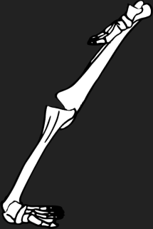 Dem bones dem bones dem – dry bones!