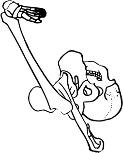 Dem bones dem bones dem – dry bones!