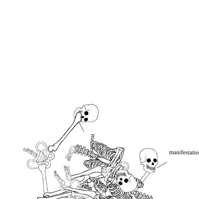 Dem bones dem bones dem – dry bones!