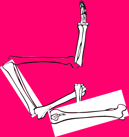 Dem bones dem bones dem – dry bones!