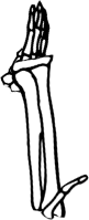 Dem bones dem bones dem – dry bones! Dem bones dem bones dem – extra bones!