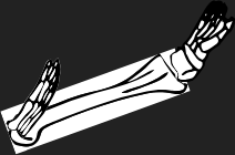 Dem bones dem bones dem – dry bones!