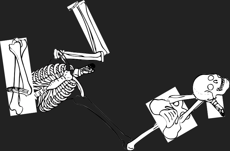 Dem bones dem bones dem – dry bones!