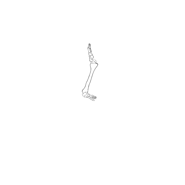 Dem bones dem bones dem – dry bones!
