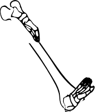 Dem bones dem bones dem – dry bones!