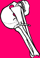 Dem bones dem bones dem – dry bones!
