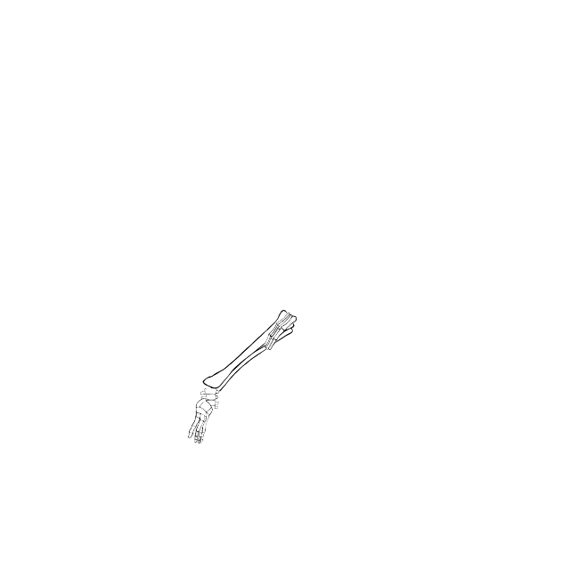 Dem bones dem bones dem – dry bones!