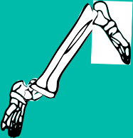Dem bones dem bones dem – dry bones!