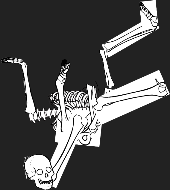 Dem bones dem bones dem – dry bones!