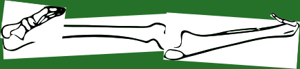 Dem bones dem bones dem – dry bones!
