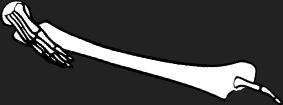 Dem bones dem bones dem – dry bones!