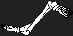 Dem bones dem bones dem – dry bones!
