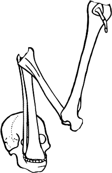 Dem bones dem bones dem – dry bones!