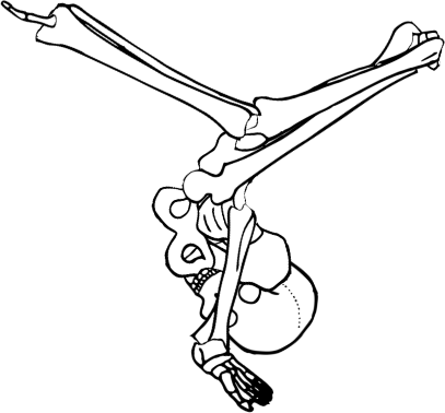 Dem bones dem bones dem – dry bones!