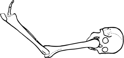 Dem bones dem bones dem – dry bones! Dem bones dem bones dem – extra bones!