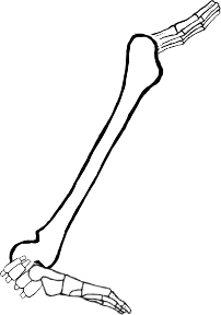 Dem bones dem bones dem – dry bones!