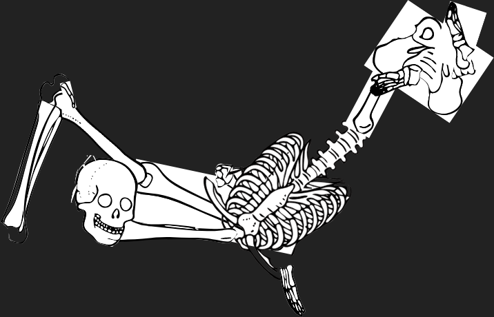 Dem bones dem bones dem – dry bones!