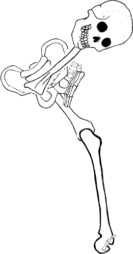 Dem bones dem bones dem – dry bones!