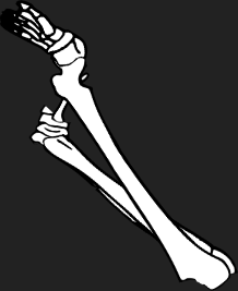 Dem bones dem bones dem – dry bones!