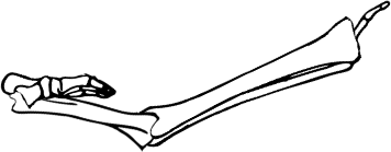 Dem bones dem bones dem – dry bones!