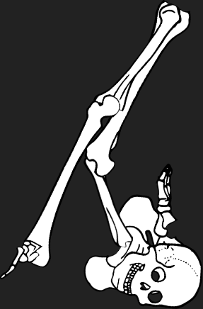 Dem bones dem bones dem – dry bones!