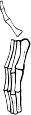 Dem bones dem bones dem – dry bones!