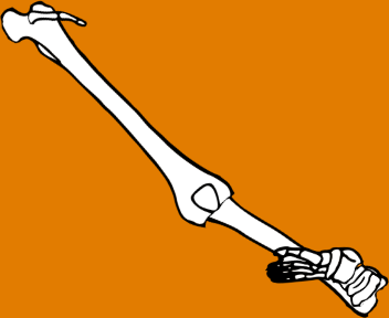 Dem bones dem bones dem – dry bones!