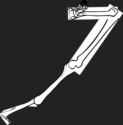 Dem bones dem bones dem – dry bones!
