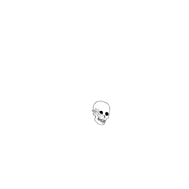 Dem bones dem bones dem – dry bones!