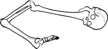 Dem bones dem bones dem – dry bones!