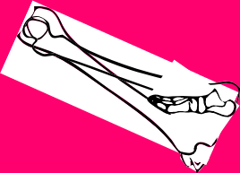 Dem bones dem bones dem – dry bones!