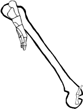 Dem bones dem bones dem – dry bones!