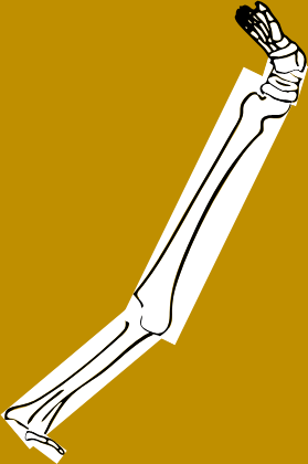 Dem bones dem bones dem – dry bones!