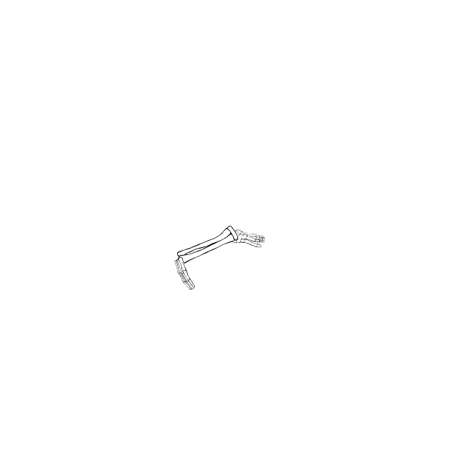 Dem bones dem bones dem – dry bones!