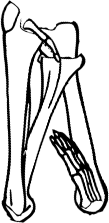 Dem bones dem bones dem – dry bones!