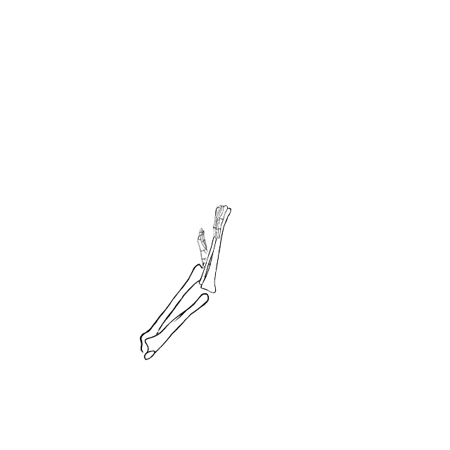 Dem bones dem bones dem – dry bones!