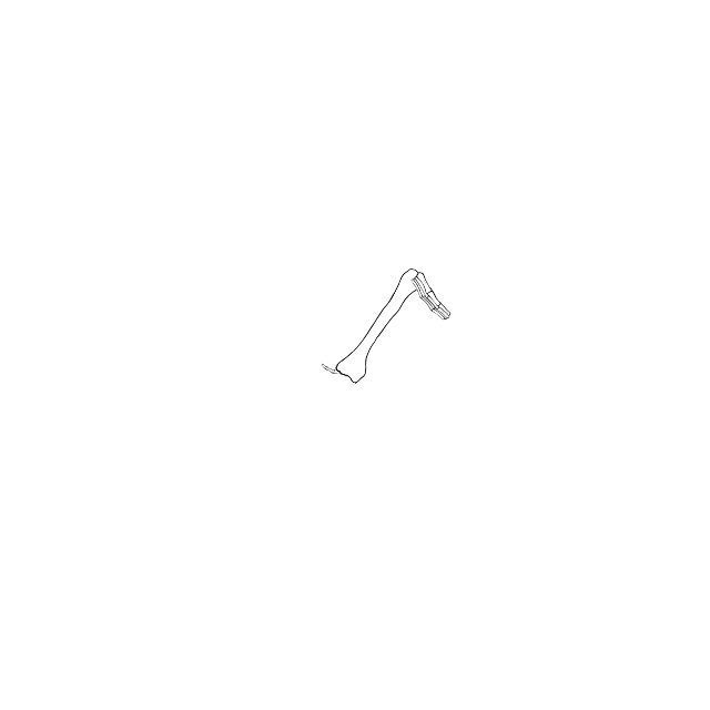 Dem bones dem bones dem – dry bones!