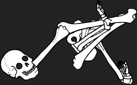 Dem bones dem bones dem – dry bones!