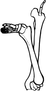Dem bones dem bones dem – dry bones! Dem bones dem bones dem – extra bones!