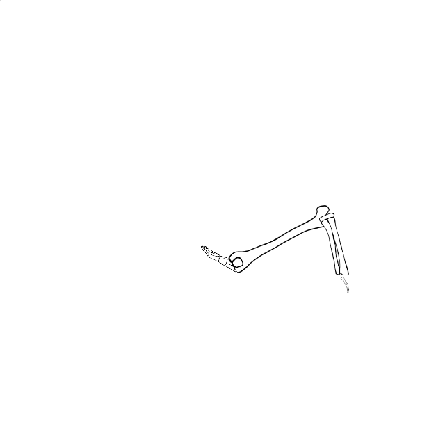 Dem bones dem bones dem – dry bones!