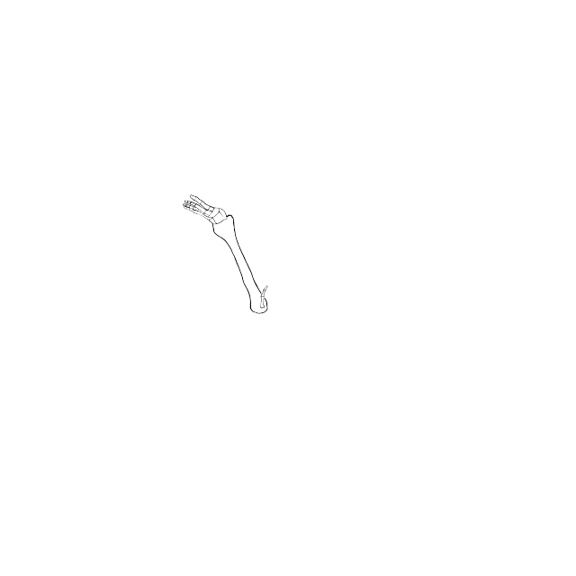 Dem bones dem bones dem – dry bones!