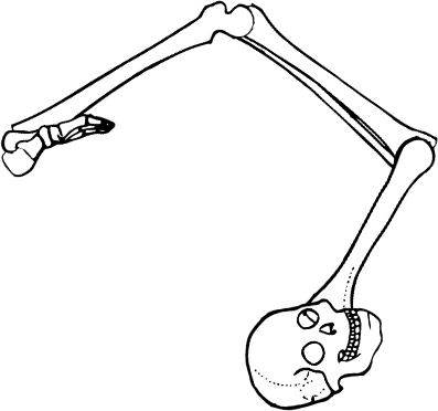 Dem bones dem bones dem – dry bones!