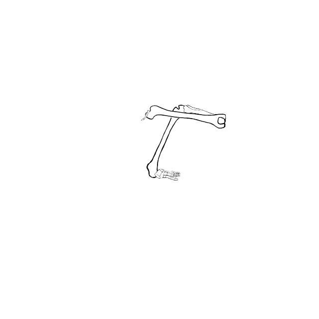 Dem bones dem bones dem – dry bones!