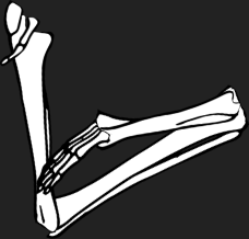Dem bones dem bones dem – dry bones!